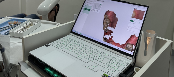 Humanização com tecnologia de implantodontia em Belo Horizonte
