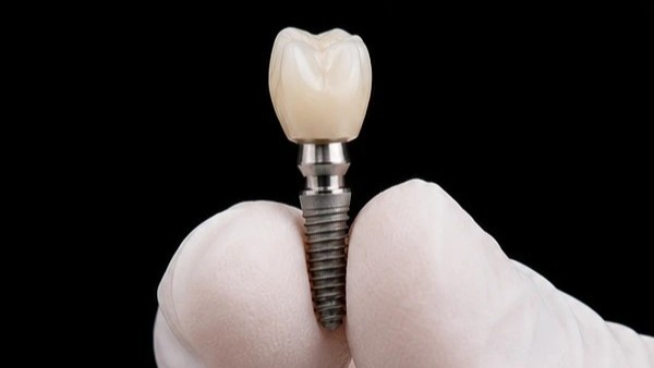 Comparação de opções de implante dentário (titânio, zircônia e carga imediata) atendidas pela ImplanVita